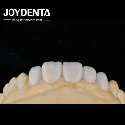 acheter Matériau de porcelaine personnalisé Veneurs de dents Emax pour une liaison esthétique élevée fabrication en ligne