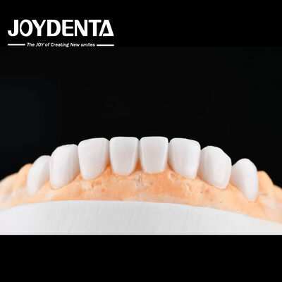 acheter Enhance Case Acceptance & Patient Communication with Our Diagnostic Wax-Up Service fabrication en ligne