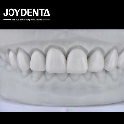 acheter Visualize the Result, Secure the Case: Our Diagnostic Wax-Up Service fabrication en ligne