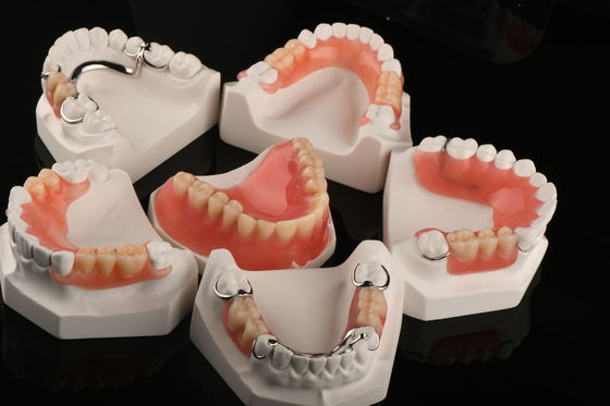 Dentiste hypoallergénique Dentiste acrylique amovible Dents artificiels Dentiste partielle amovible