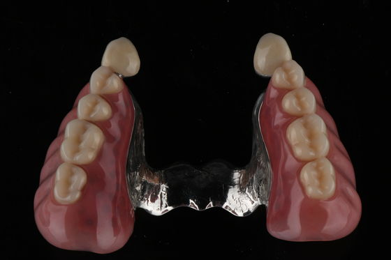 Résistant à l'odeur des taches Prothèse dentaire en acrylique complète Dentition dentaire en résine acrylique naturelle