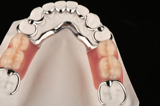 Dentures partielles en acrylique résistant aux taches pour un confort naturel