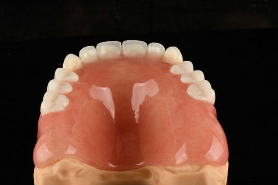 Dents en acrylique naturel pour une longue durée de confort