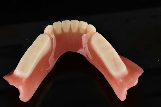 Préparation d'une dentition hypoallergénique artificielle en acrylique pour remplacer les dents naturelles
