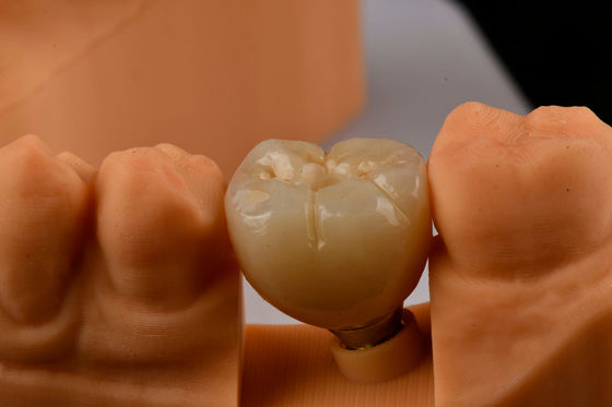 Implantologie orale auto-tapping Implantations dentaires à dent unique avec connexion hexagonale interne