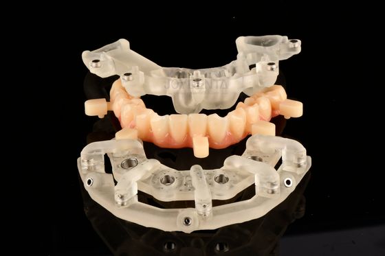 Des solutions de chirurgie guidée statique en titane pour la thérapie des implants très précises