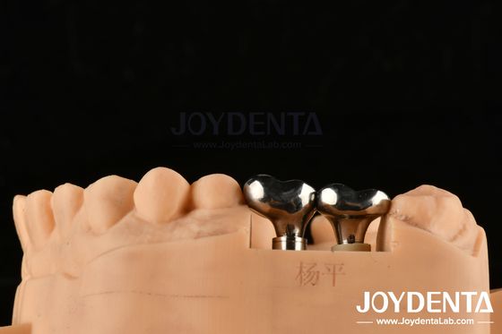 Dentiste d'implants en argent abutments de diamètre personnalisable hauteur de la technologie CAD CAM