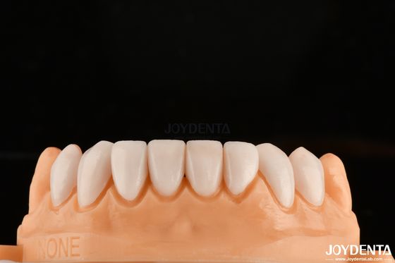 Une forte liaison avec l'émail dentaire pour des placages dentaires adaptés à la sécurité Personnalisation pour des nuances personnalisées pour correspondre aux dents naturelles