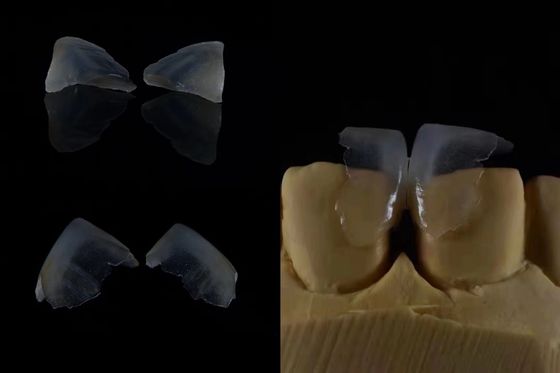 Les facettes dentaires confortables Une liaison solide avec l'émail dentaire pour un ajustement sécurisé Légère et lisse Pour un confort optimal du patient