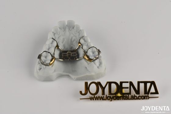 Retenus dentaires orthodontiques réglables pour redresser les dents Santé bucco-dentaire Confortable