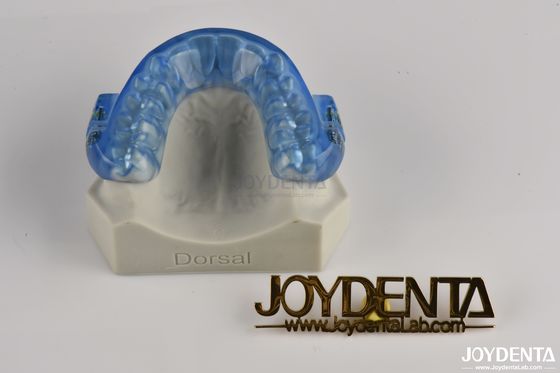 Mouthpiece réglable contre le ronflement / protecteur de la bouche contre le ronflement toute la nuit