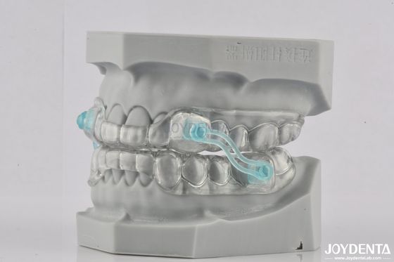 Pour adultes, appareil de ronflement transparent en silicone, outil d'arrêt du ronflement, couleur transparente