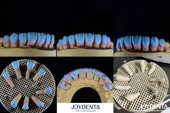 Biocompatibilité élevée Finition céramique feldspathique brillante pour les restaurations dentaires