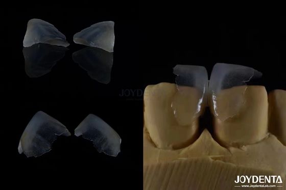 Minimalement invasif Faisceaux dentaires cosmétiques en verre en céramique Couleur ultra-mince