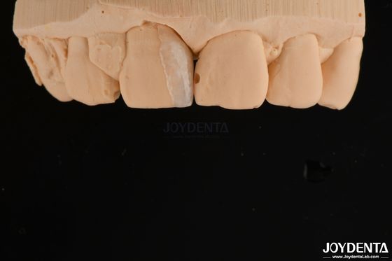 Les produits de traitement des dents sont utilisés pour la fabrication de produits cosmétiques.