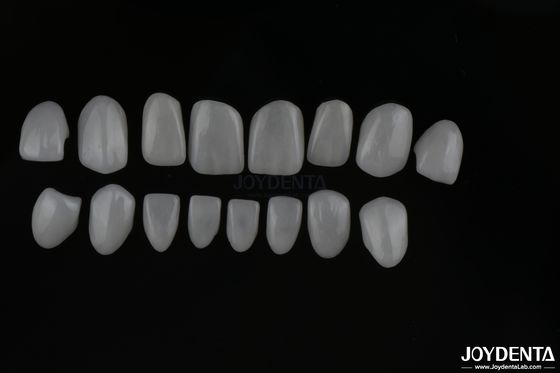 Veneurs de dents en céramique en verre à l'aspect réel avec une surface brillante ou mate