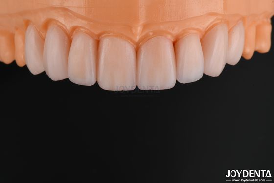 Façade en verre céramique personnalisable, à l'aspect naturel, résistante aux produits chimiques