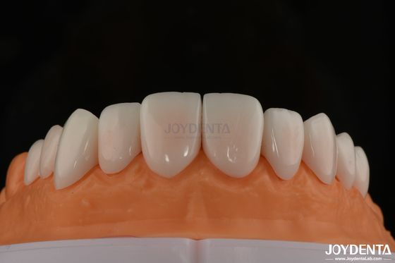 A1-A4 Ips Emax Presse Porcelaine Faisceaux dentaires résistant aux taches Forme personnalisable