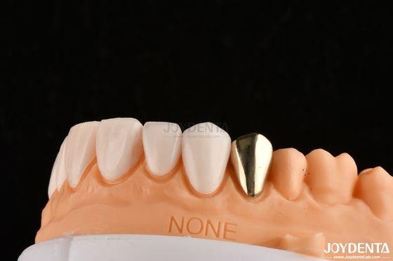 Ultra-mince IPS Emax Presse Faisceaux Faisceaux cosmétiques pour les dents Pour les restaurations antérieures et postérieures