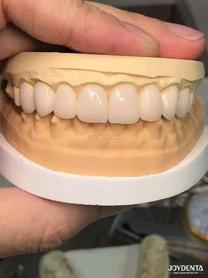 16 nuances Couleur Émax Faisceaux dentaires A1-A4 Haute résistance aux taches pour un sourire parfait