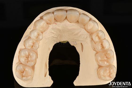 Hautement résistant à la corrosion, le zirconium complet est le matériau préféré pour les restaurations dentaires blanches