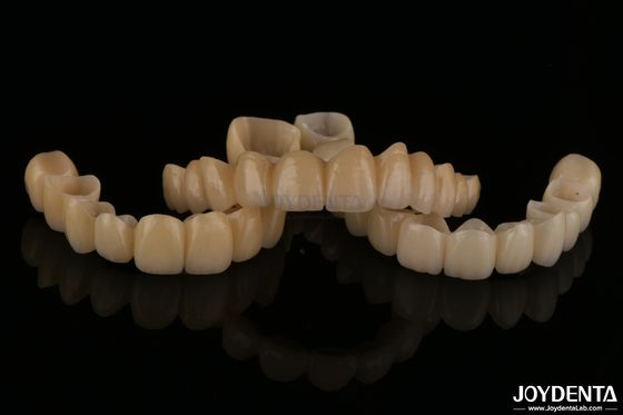 Les ponts en zirconium couchés en porcelaine d'aspect naturel résistent à l'usure