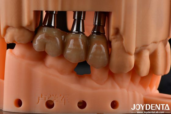 Résistance à la flexion élevée Multicouche Solution dentaire en zirconium complet Restaurations à pleine arche