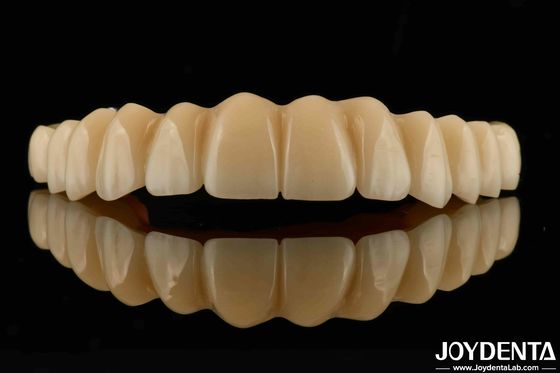 Besoins de personnalisation de pont hybride à base de titane de zirconium