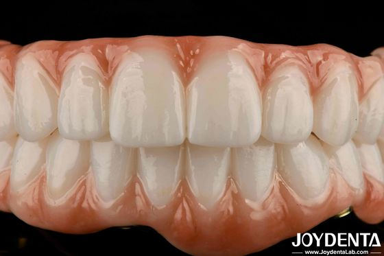 Barre de titane de longue durée Zirconia pont hybride d' apparence naturelle esthétique pour la restauration