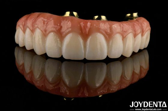 Confortable à porter Barre de titane Zirconia Pont hybride Biocompatibilité élevée Durable