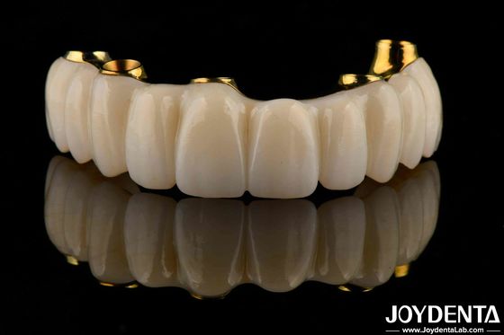 Barre de titane dentaire de précision hybride Zirconia Bridge personnalisation Biocompatibilité élevée