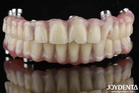 Appareil dentaire de laboratoire naturel Les dents en acrylique pour une résistance élevée à l'usure