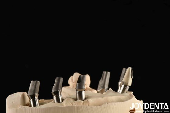 Fabrication sur commande de titane poli, abutment de ciment, rétention de fil en forme de V