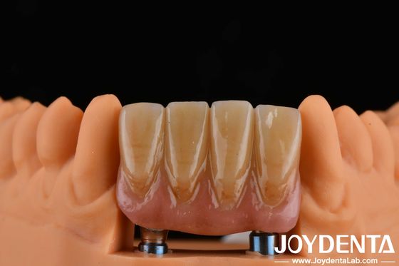 4.5 mm de hauteur Abutments finis Type de connexion hexagonale interne Compatible avec les systèmes d'implant