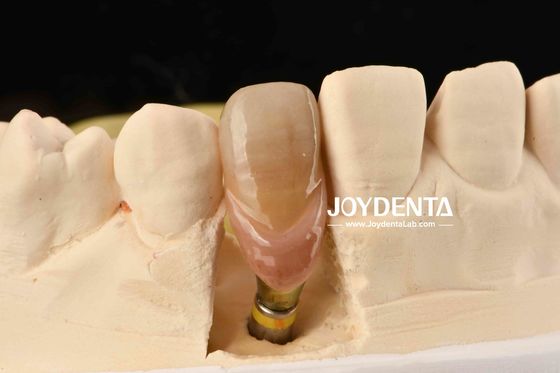 0° Angulation Abutments dentaires finis 1,5 mm filetage de fil Surface polie