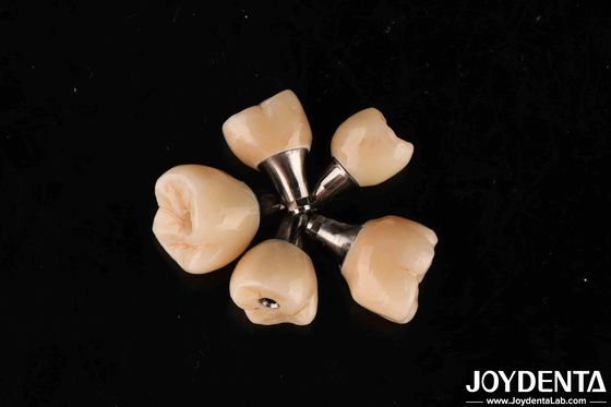 Retention de vis Abutments en titane Connexion hexagonale interne pour les implants dentaires