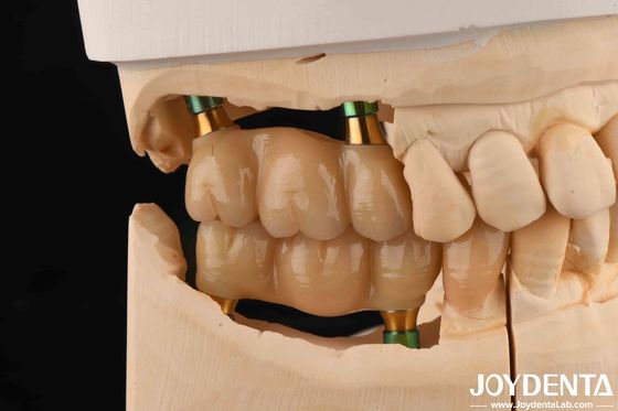 4.5 mm de hauteur Polie intégrale hexagonale Abutments d'implants dentaires en forme de V vis retenue