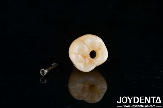Implants dentaires en titane hexagonale interne, usinage de précision à angle zéro