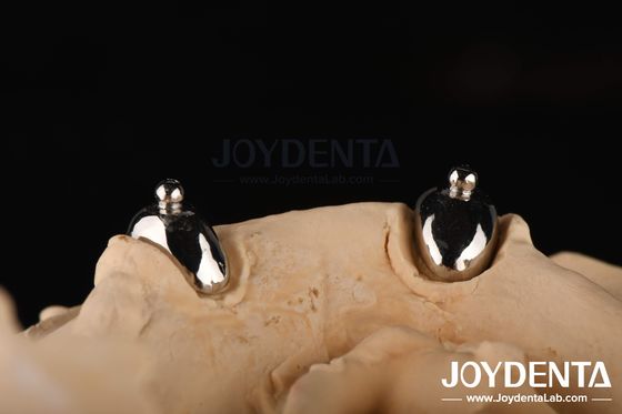 Joydental laboratoire dentaire
