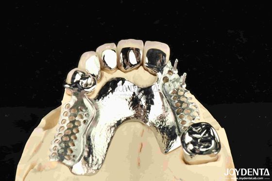 En alliage métallique cadre dentaire amovible portable pour les dentistes