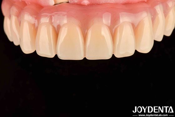 Traitement dentaire Dentiste de haute élasticité Finition acrylique pour les dents