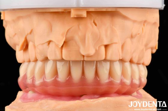 Une denture naturelle en acrylique avec une haute biocompatibilité grâce à la technologie d'arrangement des dents