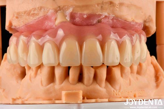 Prothèse dentaire acrylique finie avec technologie d'aménagement des dents