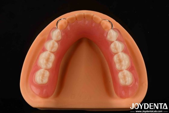 Personnalisation Prothèse dentaire acrylique Finition Léger Elasticité élevée