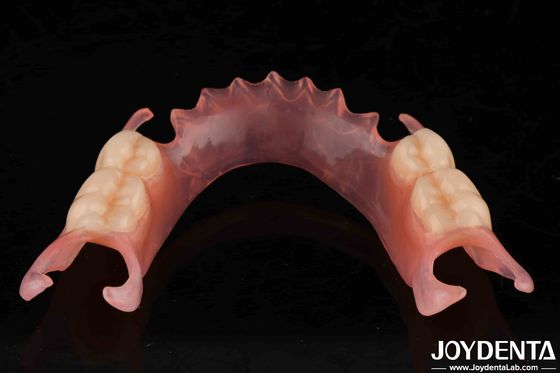 Dentition flexible et confortable avec une finition très discrète