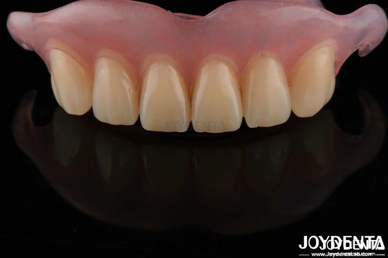 Une dentition souple et amovible, finie, confortable et adaptée.