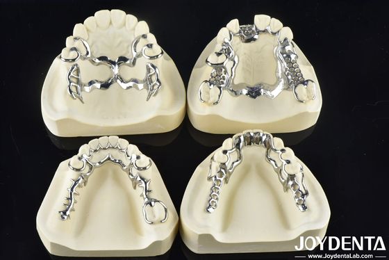 Cadre dentaire amovible pour s'adapter à la bouche pour soutenir la mastication