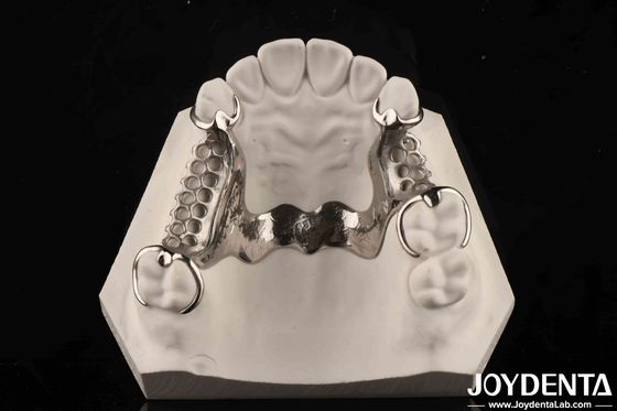 Pratique clinique Dentistique cadre métallique en alliage
