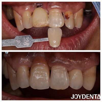 Vérifications de l'apparence des dents