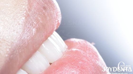 Finition dentaire composite durable Bonne biocompatibilité Pas de goutte de finition de porcelaine